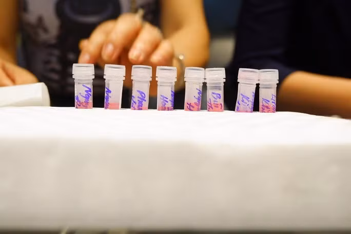 Số mẫu xét nghiệm của những người liên quan đầu tiên ca nghi nhiễm được thu thập đưa đi xét nghiệm