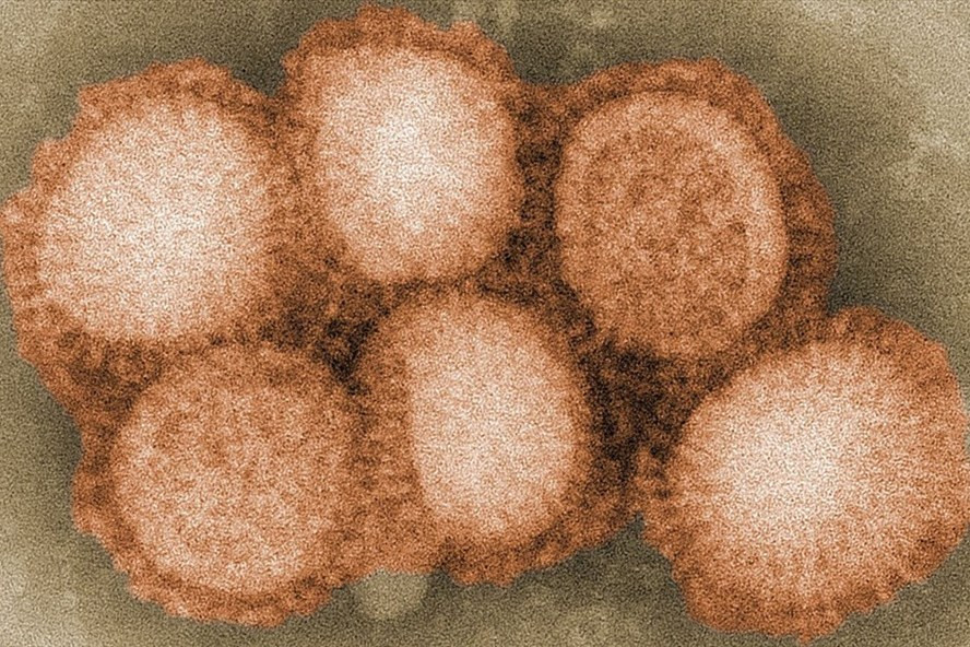 Giới khoa học Trung Quốc cảnh báo virus cúm gia cầm H5N8 có thể gây đại dịch mới. Ảnh: Wiki