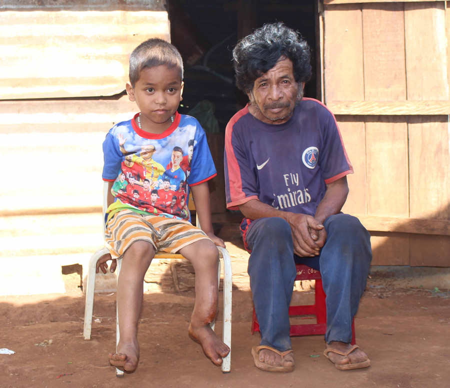  Gia đình em Rơ Châm Phước là hộ nghèo ở làng Pok. Bố em-ông Rơ Châm Jít bị tàn tật, còn Phước bị bệnh cần tiền chữa trị. Ảnh: Ảnh: Thủy Bình