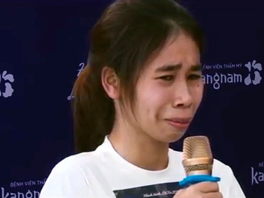 Cao Thị Lan trước khi phẫu thuật. ẢNH: NVCC