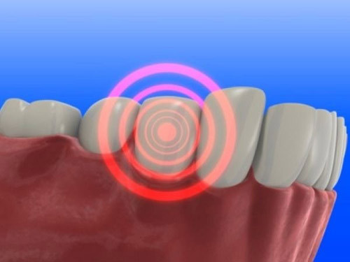 Sức khỏe răng miệng xấu không chỉ ảnh hưởng đến tim mà còn ảnh hưởng đến não. Sức khỏe răng miệng xấu không chỉ ảnh hưởng đến tim mà còn ảnh hưởng đến não.