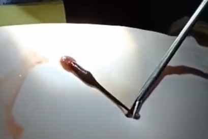 Con đỉa đã được gắp ra khỏi mũi nạn nhân. Ảnh: Văn Ngọc 