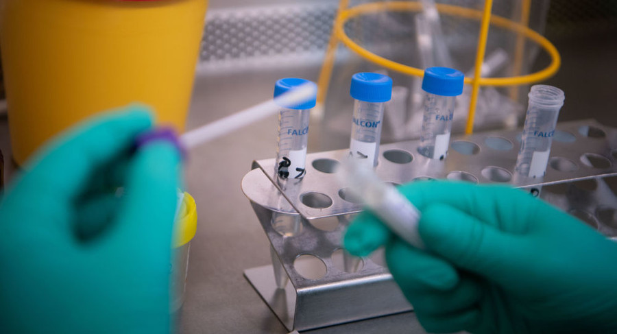 Triệu chứng lâm sàng của virus corona đã có nhiều biến đổi. Triệu chứng lâm sàng của virus corona đã có nhiều biến đổi.