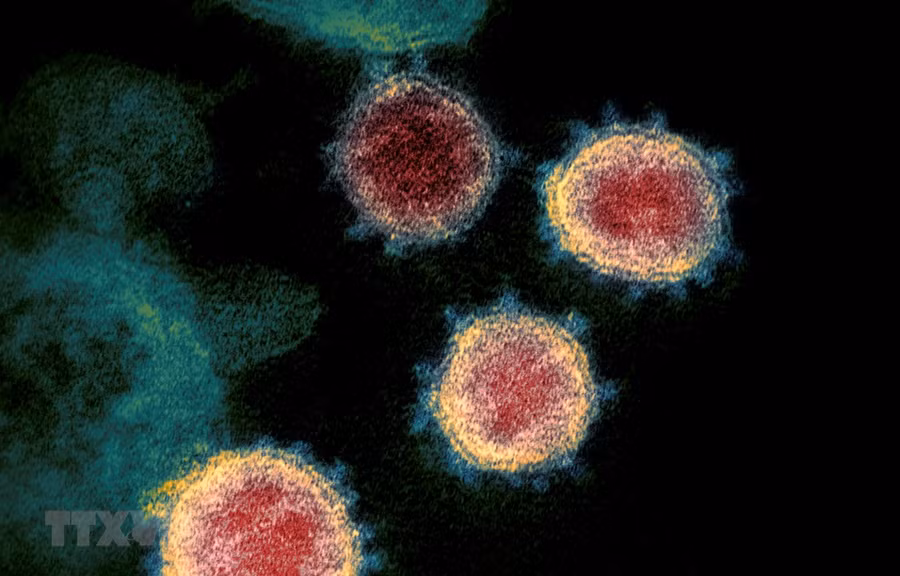 Virus SARS-CoV-2 gây bệnh COVID-19 soi trên kính hiển vi. (Ảnh: AFP/ TTXVN)