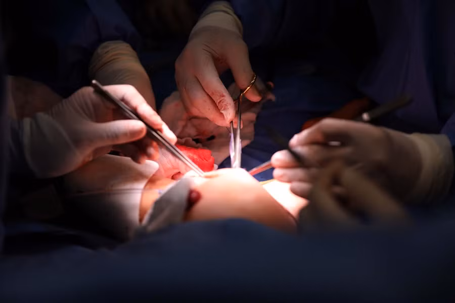 Hai bé là con của sản phụ 25 tuổi (ngụ Q.9, TP.HCM) mang thai lần đầu, sinh ngày 7.6.2019 tại Bệnh viện Hùng Vương (TP.HCM). Cặp song sinh được xác định dính nhau vùng bụng chậu, tứ chi đầy đủ, hai cơ quan sinh dục, một hậu môn ẢNH: NGỌC DƯƠNG