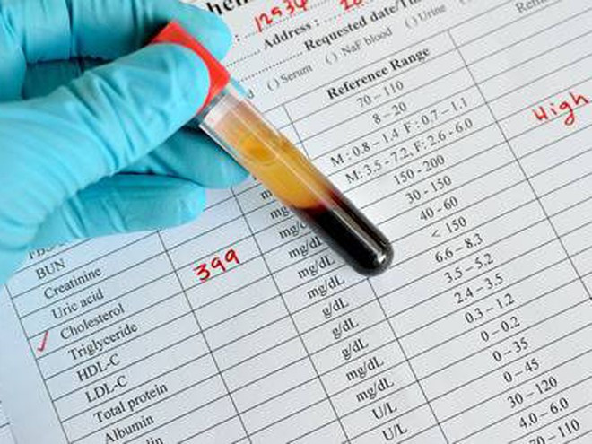 Nghiên cứu mới đã phát hiện, không phải mỡ, mà chính chất đường bột mới là thủ phạm chính gây ra mỡ máu ẢNH MINH HỌA: SHUTTERSTOCK