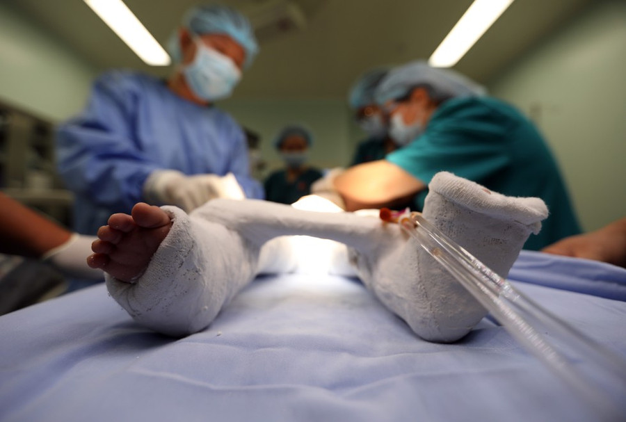 Sau khi hoàn thành phẫu thuật chỉnh hình các bé được bó bột từ vùng xương chậu đến hết chân trước khi chuyển sang phòng hồi sức hậu phẫu ẢNH: NGỌC DƯƠNG