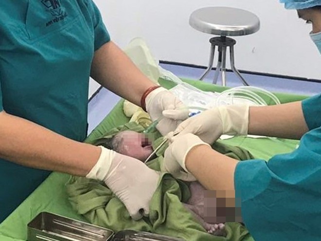 Mọi cha mẹ đều mong muốn sinh con ra khỏe mạnh ẢNH: D.T