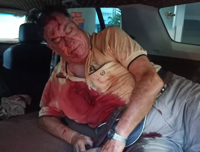 Ông Stuart Surtess bị thương khá nặng được người dân đưa tới bệnh viện. Ảnh: N.Tuấn