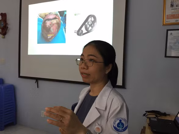 ThS.BS Diệp Quế Trinh đang thông tin về phương pháp ghép da mới vừa được Bệnh viện Nhi Đồng 1 TP.HCM áp dụng .Ảnh: THÙY DƯƠNG