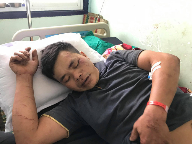 Một nạn nhân trong vụ lật xe khách đang được điều trị tại bệnh viện. Một nạn nhân trong vụ lật xe khách đang được điều trị tại bệnh viện.