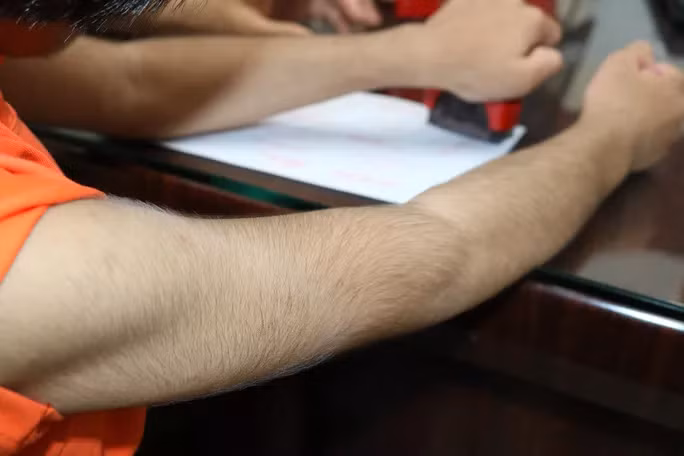 Toàn thân bé C. rậm lông