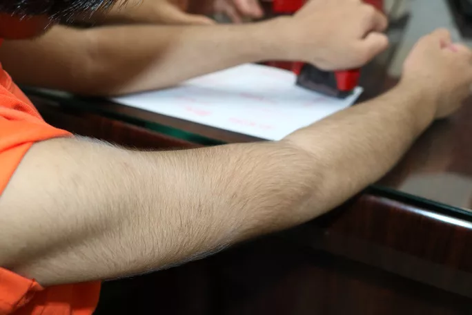 Toàn thân bé C. rậm lông