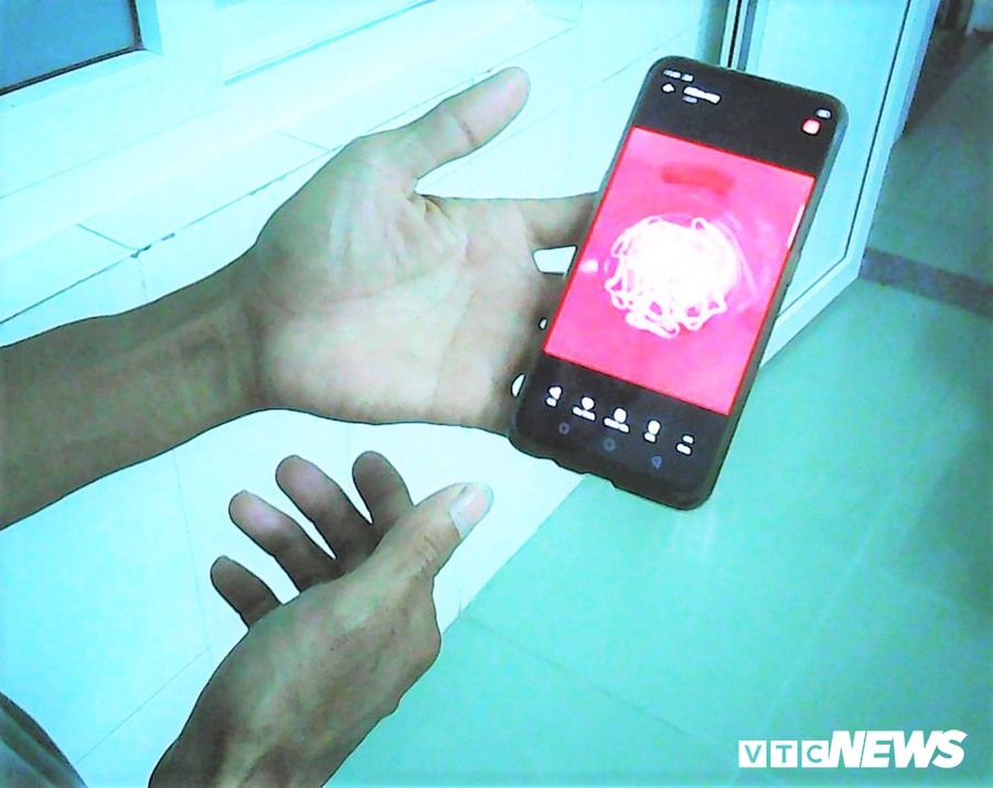 Con sán xơ mít dài 9m được chụp lại sau khi xổ ra ngoài thành công. (Ảnh: B.T) 