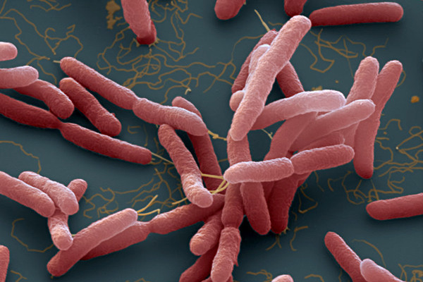 Hình dạng của vi khuẩn B. pseudomallei Hình dạng của vi khuẩn B. pseudomallei