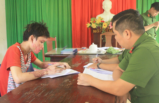 Dương Văn Tuấn lãnh 8 năm tù, cùng gương mặt bị hủy hoại. Ảnh: N.T Dương Văn Tuấn lãnh 8 năm tù, cùng gương mặt bị hủy hoại. Ảnh: N.T