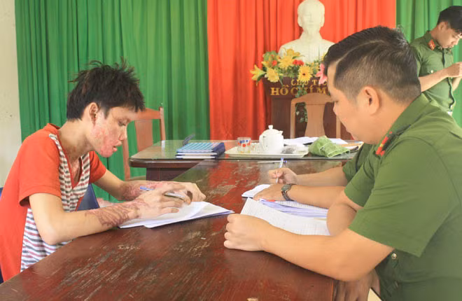 Dương Văn Tuấn lãnh 8 năm tù, cùng gương mặt bị hủy hoại. Ảnh: N.T