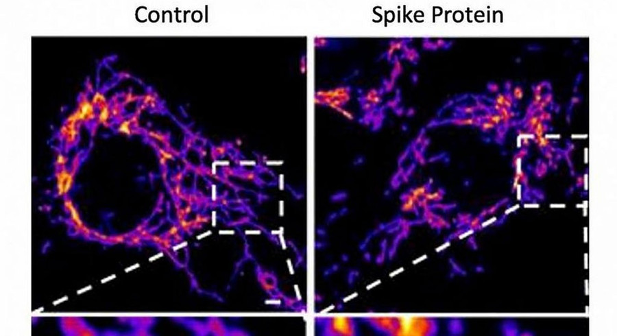 Protein S của vi rút là phần gai nhọn trên hình vương miện tấn công vào thụ thể ACE2, làm hỏng các ty thể, nơi tạo ra năng lượng cho các tế bào và làm tổn thương lớp nội mạc, nơi có các mạch máu. Ảnh: Shutterstock