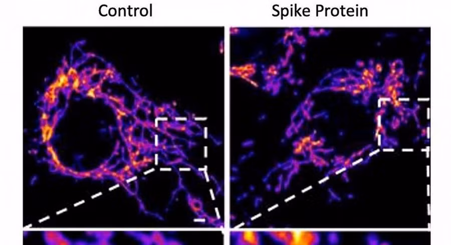 Protein S của vi rút là phần gai nhọn trên hình vương miện tấn công vào thụ thể ACE2, làm hỏng các ty thể, nơi tạo ra năng lượng cho các tế bào và làm tổn thương lớp nội mạc, nơi có các mạch máu. Ảnh: Shutterstock
