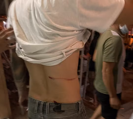 Một thanh niên bị nhóm đối phương chém vào vùng thắt lưng