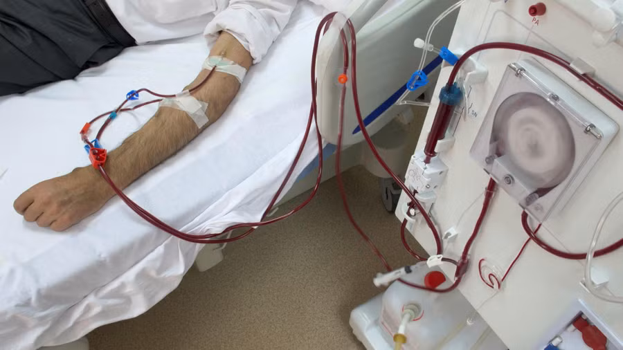 Một số căn bệnh ảnh hưởng đến thận, có thể gây suy thận. Ảnh: Shutterstock 