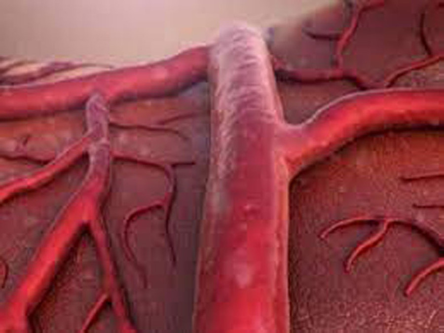 Các nhà nghiên cứu phát hiện Covid-19 là bệnh liên quan đến mạch máu. Ảnh: Shutterstock