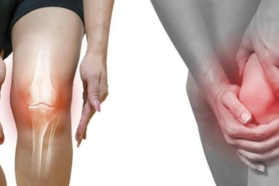 Viêm khớp gối là một triệu chứng phổ biến có thể xuất hiện ở mọi lứa tuổi. Ảnh: Pinterest