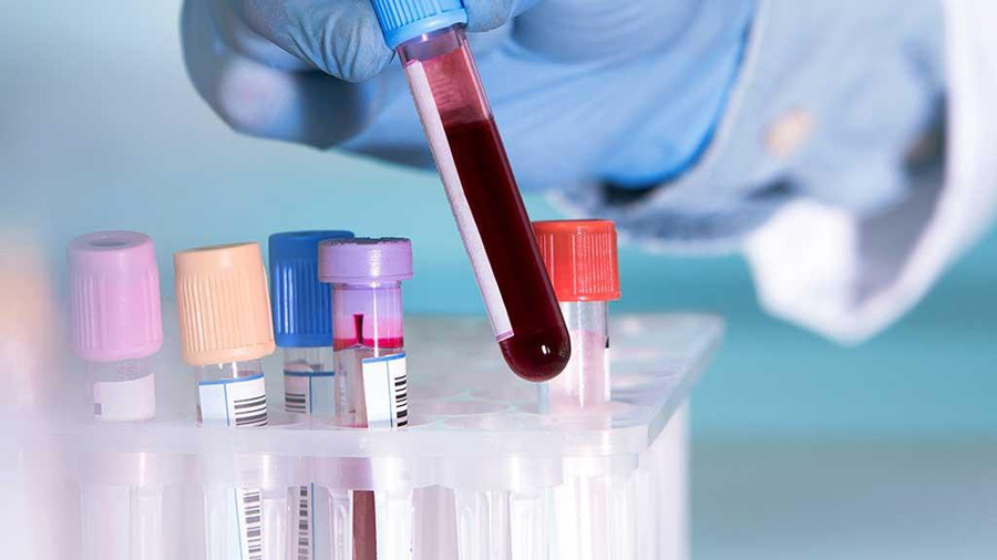 Xét nghiệm máu mới phát hiện ung thư di căn chính xác đến 94%. Ảnh: Shuterstock