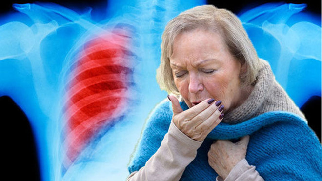 Nếu ho kéo dài liên tục vài ngày không bớt, bạn cần đi khám ngay. ẢNH MINH HỌA: SHUTTERSTOCK