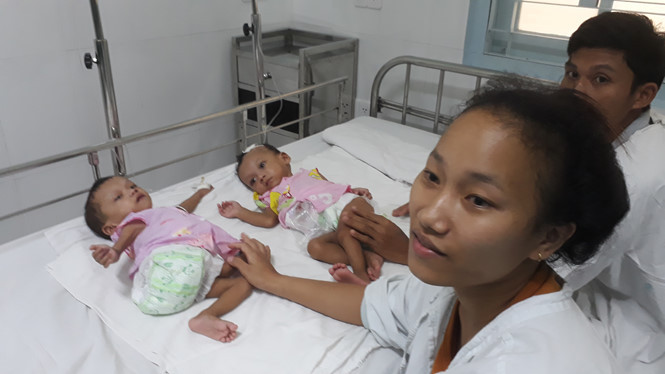 Niềm vui của gia đình khi 2 bé đã được tách rời Niềm vui của gia đình khi 2 bé đã được tách rời