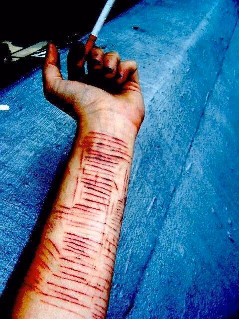 Tự ngược đãi bản thân - Ảnh minh họa Tự ngược đãi bản thân - Ảnh minh họa