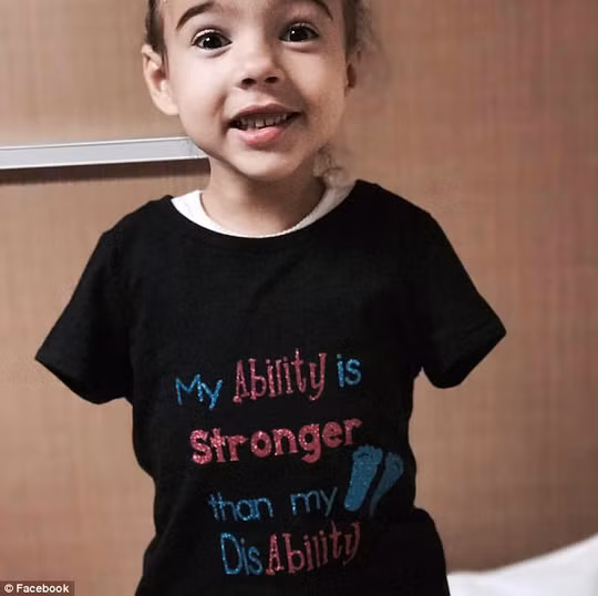 Bé Pranke mặc áo thun có dòng chữ: "Khả năng của cháu là mạnh mẽ hơn khuyết tật của mình" Bé Pranke mặc áo thun có dòng chữ: