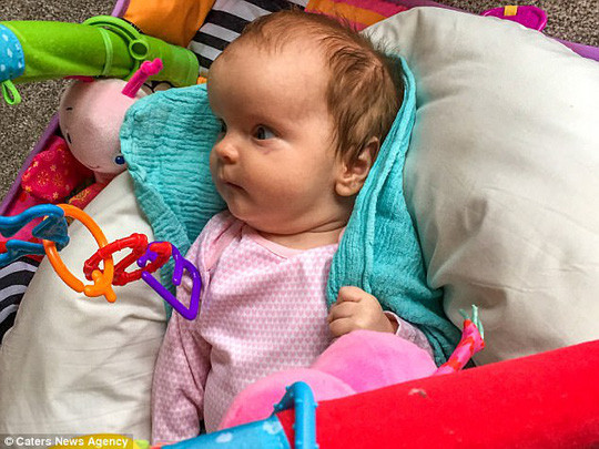 Lucy lúc mới sinh với chiếc sọ 