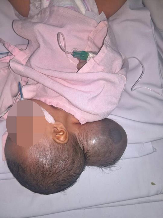 Cháu bé khi mới nhập viện - ẢNH DO BỆNH VIỆN NHI ĐỒNG 1 CUNG CẤP