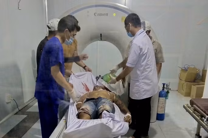 Cấp cứu người bị trúng đạn trong vụ nổ súng