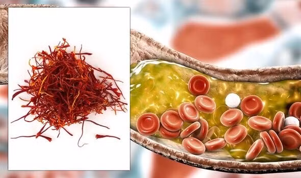 Nhụy hoa nghệ tây - còn gọi là Saffron có thể có thể giảm mức cholesterol LDL “xấu” chỉ sau 3 tuần. Ảnh: Shutterstock