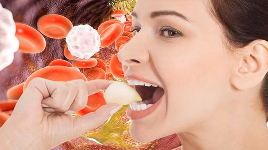  Nghiên cứu cho thấy chỉ cần ăn 1 tép tỏi mỗi ngày trong 3 tháng là đủ để giảm tổng lượng cholesterol xuống 9%. Ảnh: Shutterstock