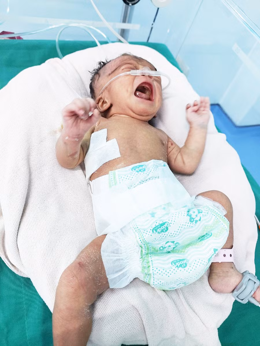 Bệnh nhi sau khi được phẫu thuật. Ảnh: PH