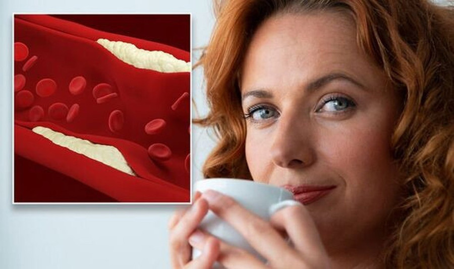  Nghiên cứu cho thấy trà gừng có thể làm giảm cholesterol xấu LDL. Ảnh: Shutterstock