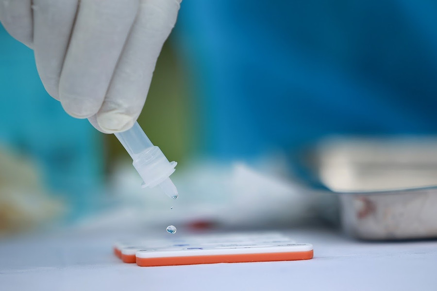 Xét nghiệm COVID-19. Ảnh: LDO