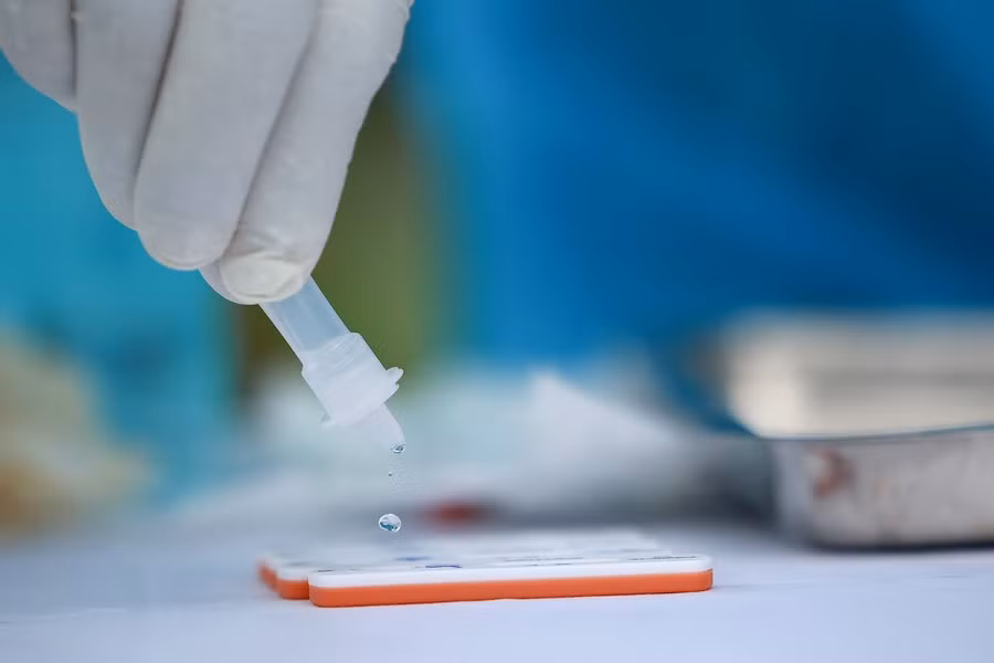 Xét nghiệm COVID-19. Ảnh: LDO