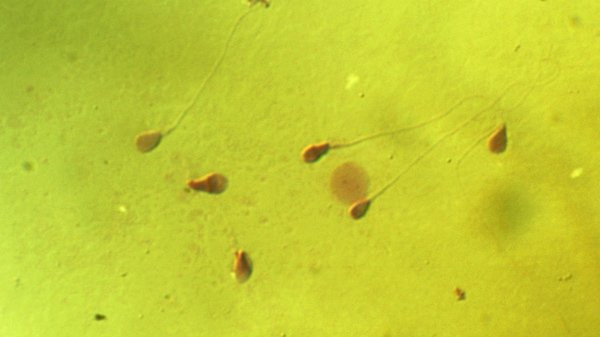  Nhóm nghiên cứu tại Đại học Harvard sẽ chỉnh sửa gene tinh trùng người.
