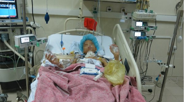 Bệnh nhân hồi phục tốt sau ghép phổi Bệnh nhân hồi phục tốt sau ghép phổi