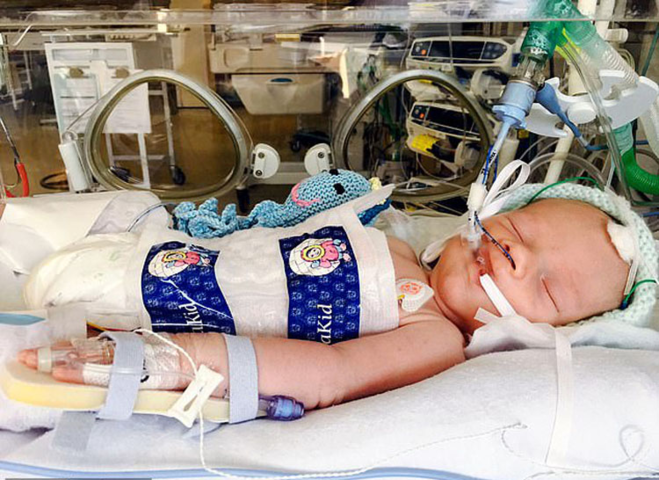 Kaleb bị tổn thương não do thiếu oxy khi mới 10 ngày tuổi. 