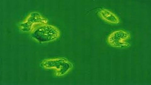 Ký sinh trùng amip.