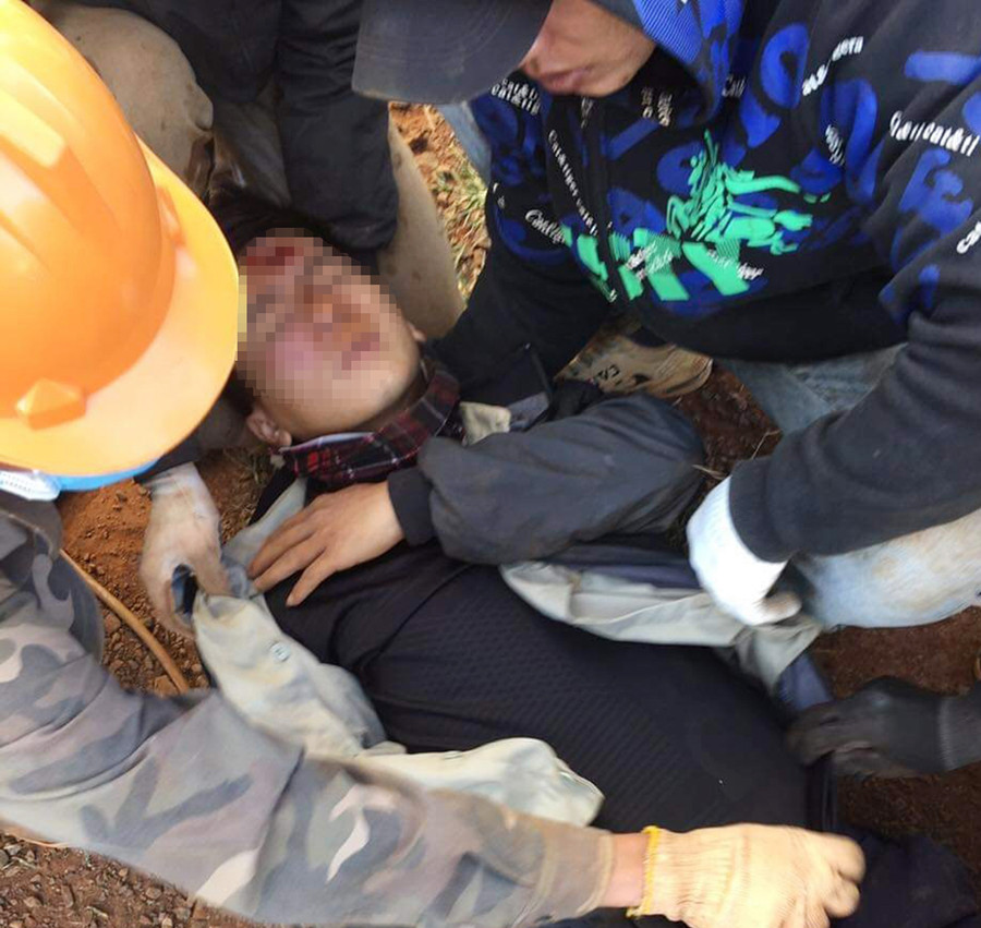 Công nhân Nguyễn Khắc Lâm bị thương nặng do thiết bị quạt gió rơi trúng người. Ảnh: Vĩnh Hoàng Công nhân Nguyễn Khắc Lâm bị thương nặng do thiết bị quạt gió rơi trúng người. Ảnh: Vĩnh Hoàng