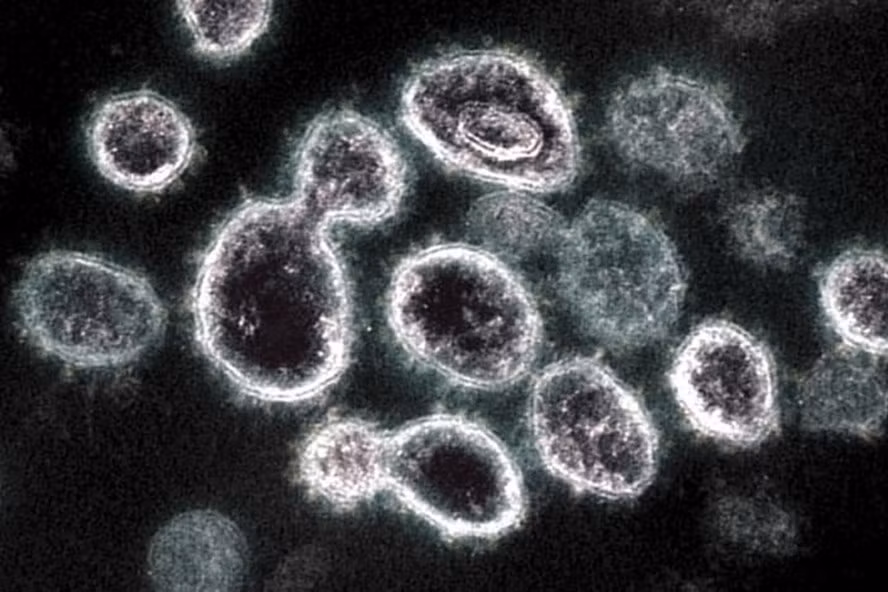 Hình minh họa biến thể Omicron. Ảnh: AFP