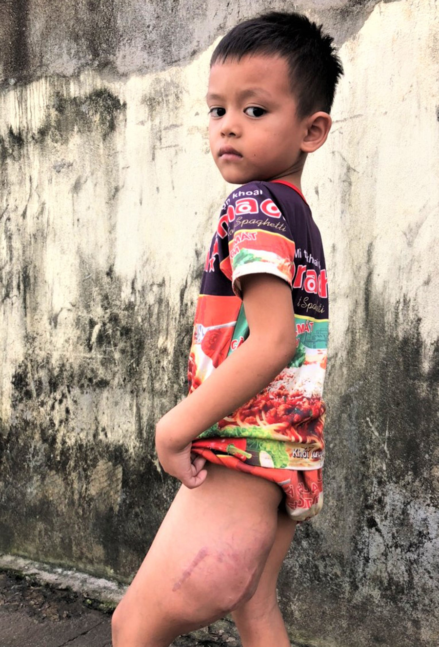 Cháu Rơ Châm Nghĩa. Ảnh: Đinh Yến Cháu Rơ Châm Nghĩa. Ảnh: Đinh Yến
