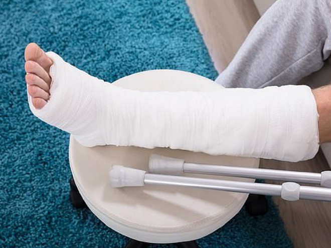 Để điều trị khối u ung thư trong xương ống chân, các bác sĩ đã cắt một đoạn xương ống chân bà Jan Ritson mang đi xạ trị rồi phẫu thuật nồi liền trở lại. ẢNH MINH HỌA: SHUTTERSTOCK