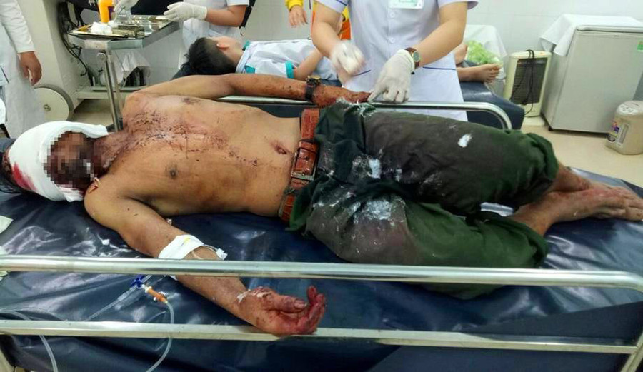 Nạn nhân Hội được người dân đưa xuống bệnh viện cấp cứu. Nạn nhân Hội được người dân đưa xuống bệnh viện cấp cứu.